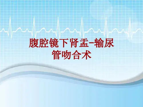 手术讲解模板：腹腔镜下肾盂-输尿管吻合术