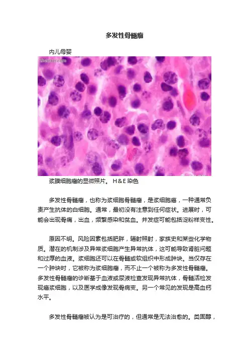 多发性骨髓瘤