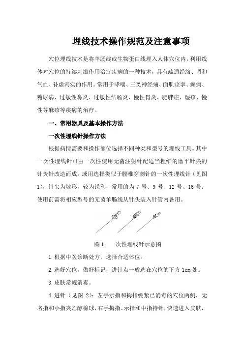 埋线技术操作规范及注意事项