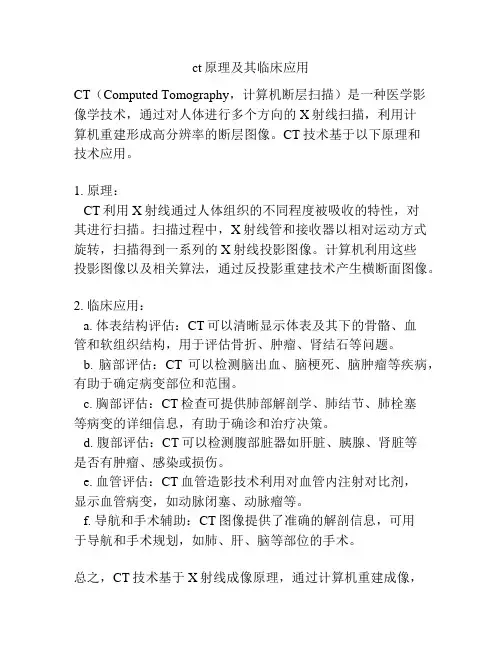 ct原理及其临床应用