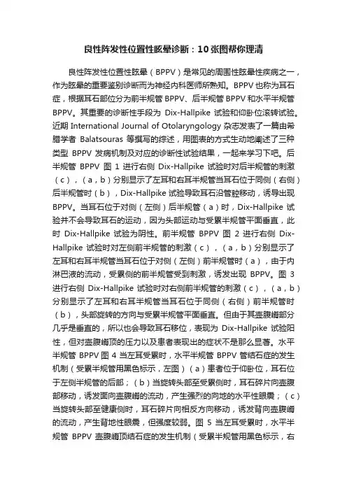 良性阵发性位置性眩晕诊断：10张图帮你理清