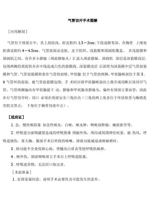 气管切开手术图解
