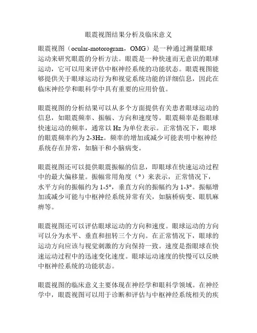 眼震视图结果分析及临床意义