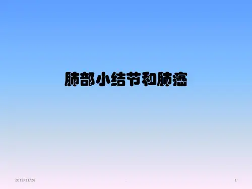 肺部小结节和肺癌PPT课件
