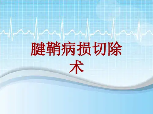 手术讲解模板：腱鞘病损切除术