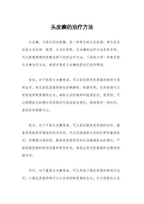 头皮癣的治疗方法