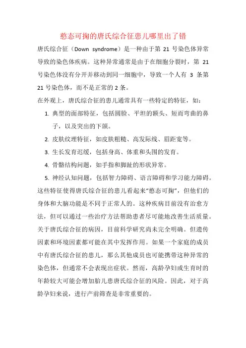 憨态可掬的唐氏综合征患儿哪里出了错