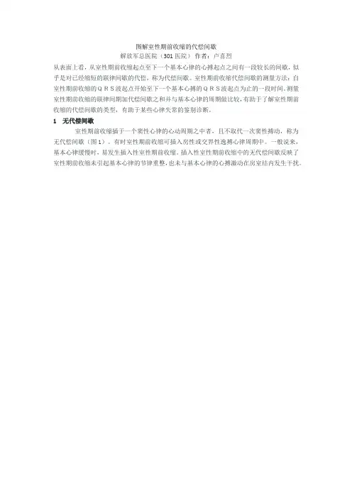 图解室性期前收缩的代偿间歇