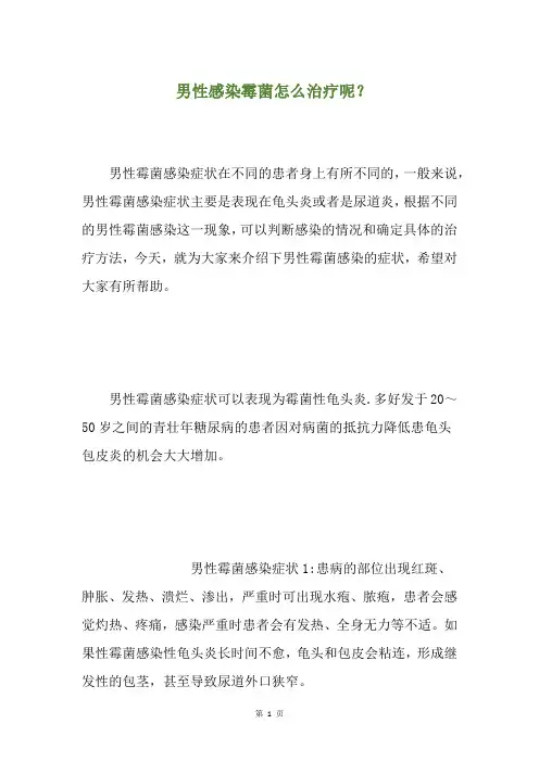 男性感染霉菌怎么治疗呢？(养生小贴士)