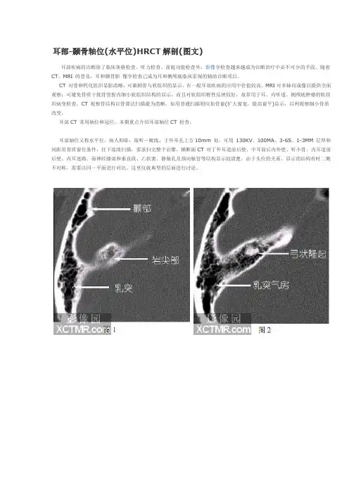 耳部CT解剖