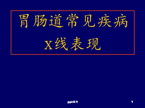 医学影像学--胃肠道常见疾病x线表现 ppt课件