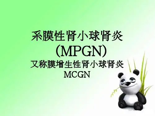 系膜性肾小球肾炎(MPGN)又称膜增生性肾小球肾炎MCGN