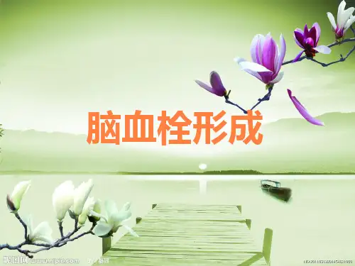 脑血栓形成病人的护理ppt课件