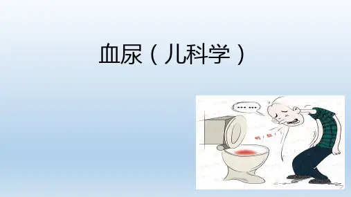 血尿的诊断及鉴别(儿科学)