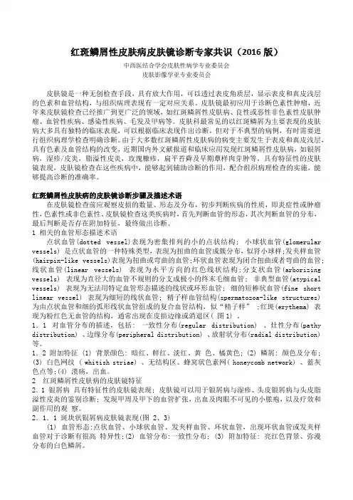 红斑鳞屑性皮肤病皮肤镜诊断专家共识(2016版)
