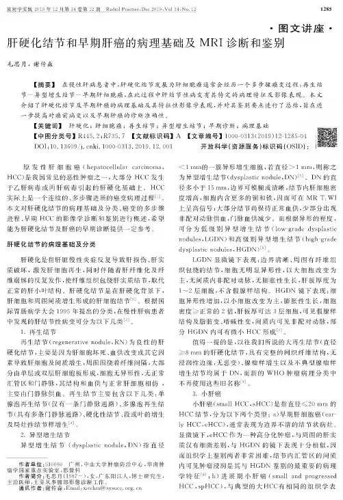 肝硬化结节和早期肝癌的病理基础及mri诊断和鉴别