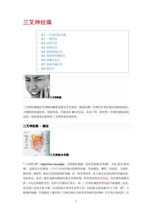 三叉神经痛