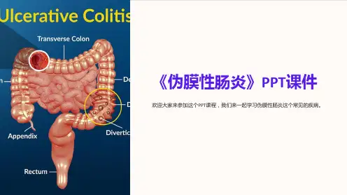 《伪膜性肠炎》课件