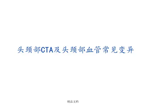 头颈部CTA及头颈部血管常见变异