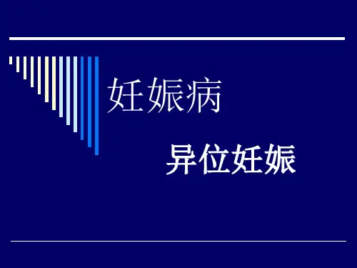 异位妊娠