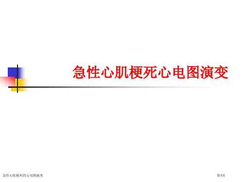 急性心肌梗死的心电图演变