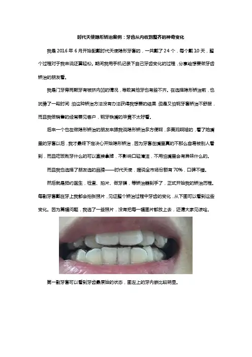 时代天使隐形矫治案例：牙齿从内收到整齐的神奇变化