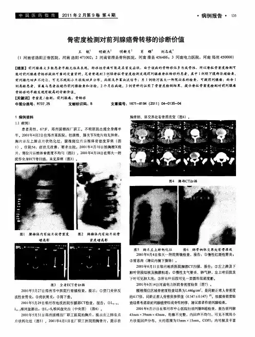 骨密度检测对前列腺癌骨转移的诊断价值