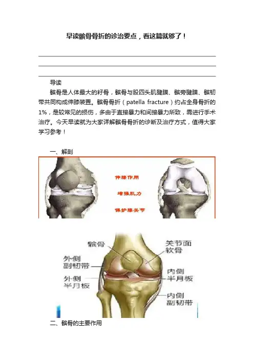 早读髌骨骨折的诊治要点，看这篇就够了！
