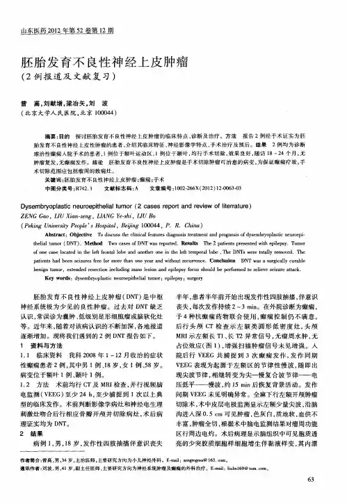 胚胎发育不良性神经上皮肿瘤(2例报道及文献复习)
