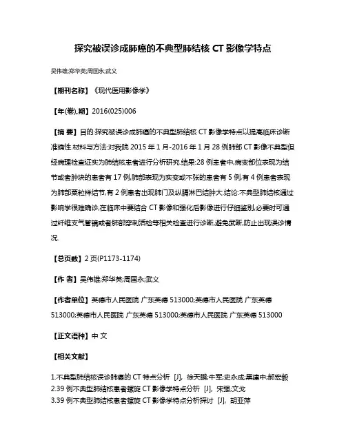 探究被误诊成肺癌的不典型肺结核CT影像学特点