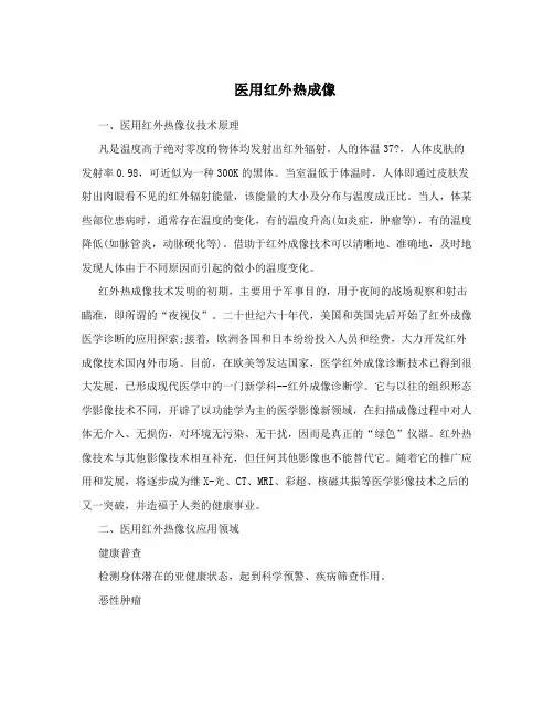 医用红外热成像