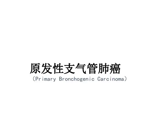 肺癌讲课课件ppt课件