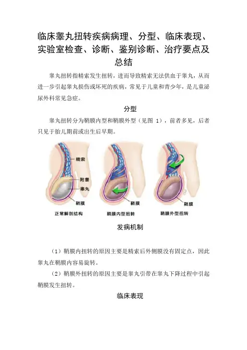 临床睾丸扭转疾病病理、分型、临床表现、实验室检查、诊断、鉴别诊断、治疗要点及总结