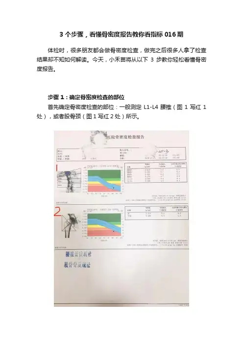 3个步骤，看懂骨密度报告教你看指标016期
