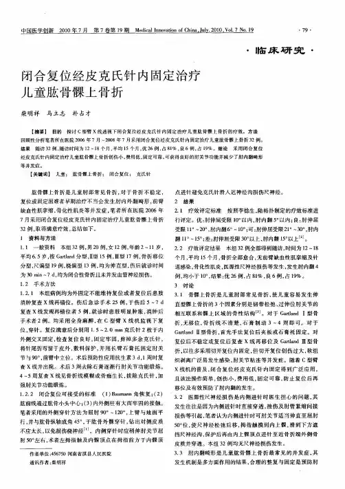 闭合复位经皮克氏针内固定治疗儿童肱骨髁上骨折