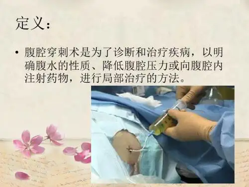 最新腹腔穿刺术及护理 ppt课件-PPT文档