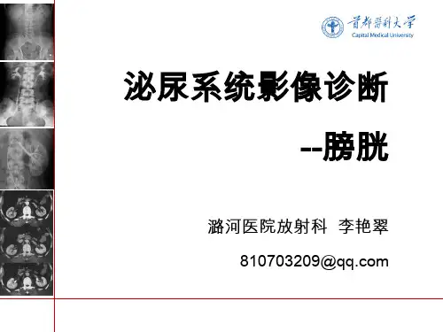 《影像诊断学》教学课件：10 泌尿系统3--膀胱