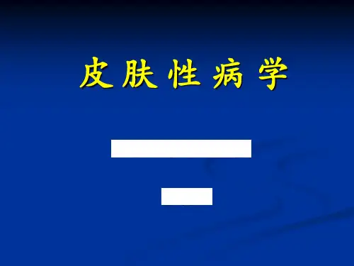 药物疹——重症药疹及治疗3