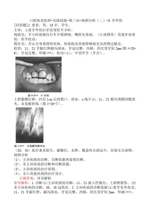 口腔执业医师-实践技能-第三站-病例分析(二)-8.牙外伤