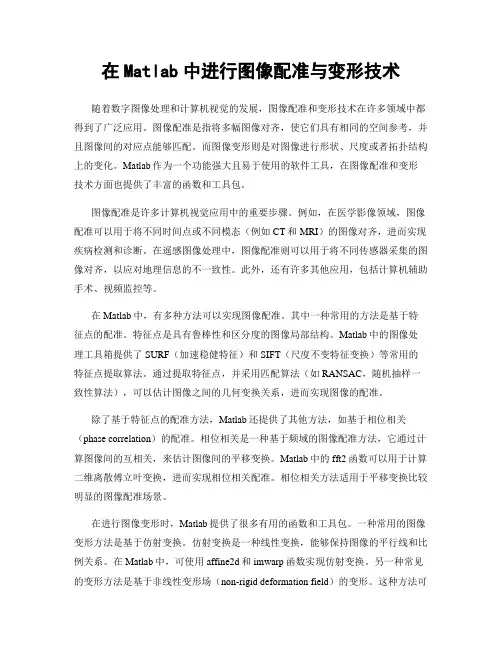 在Matlab中进行图像配准与变形技术
