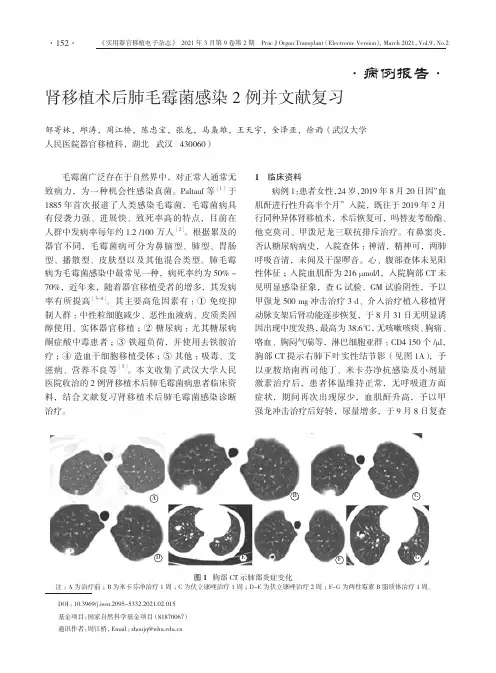 肾移植术后肺毛霉菌感染2例并文献复习