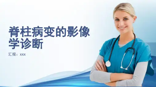 脊柱病影像学诊断ppt