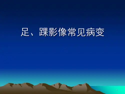 (精选课件)足踝影像
