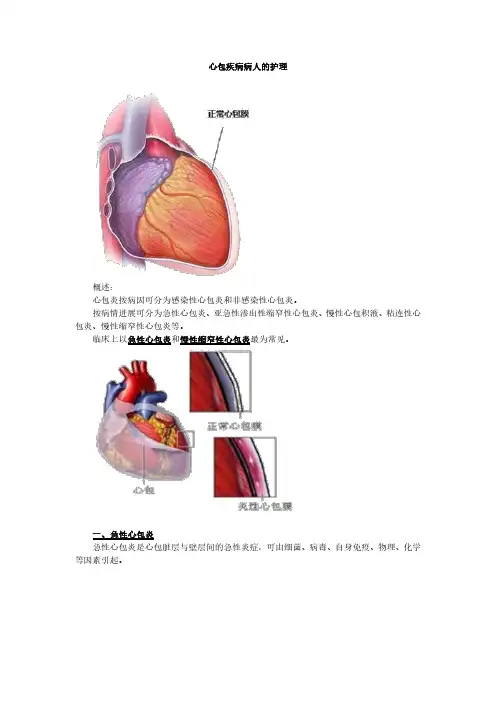 心包疾病病人的护理(护士职业资格)