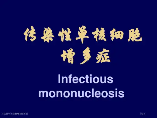 传染性单核细胞增多症新版