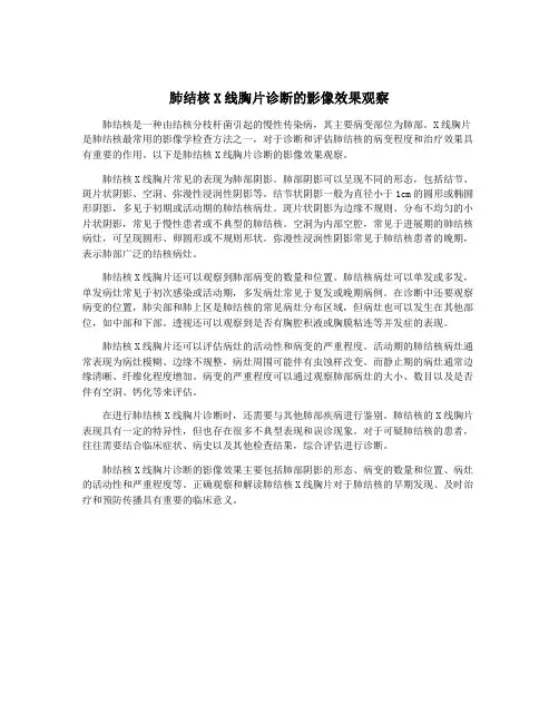 肺结核X线胸片诊断的影像效果观察