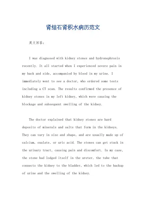 肾结石肾积水病历范文