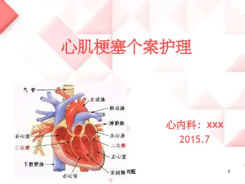急性心肌梗死护理个案