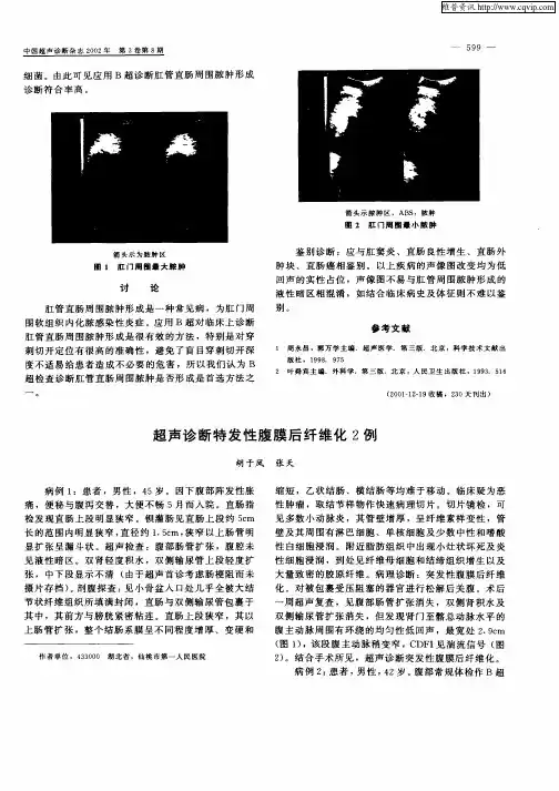 超声诊断特发性腹膜后纤维化2例