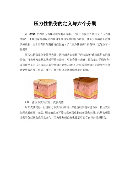 压力性损伤的定义与六个分期